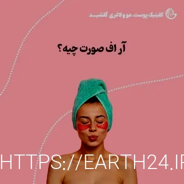 آر اف بهتر است یا هایفو